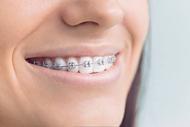 Best Tooth Extraction  in Philomath, OR